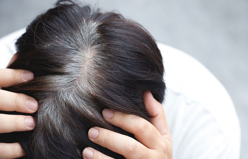 Top 6 Natural Home Remedies To Rejuvenate Dull And Limp Hair