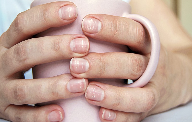 5 Things Nails Predict About Your Health