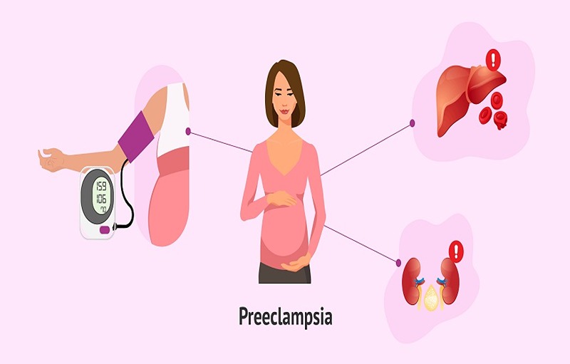 The Warning Signs of Preeclampsia, Before and After Delivery