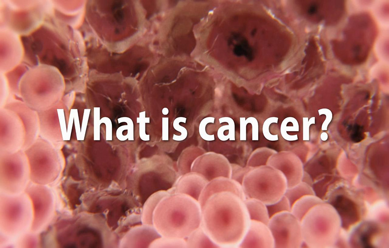Habits That Causes Brain Cancer. Read More To Know
