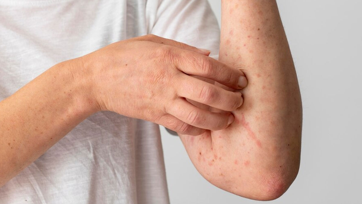 Home Remedies For Vaginal Yeast Infection
