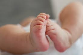 Natural Treatments To Cure Clubfoot