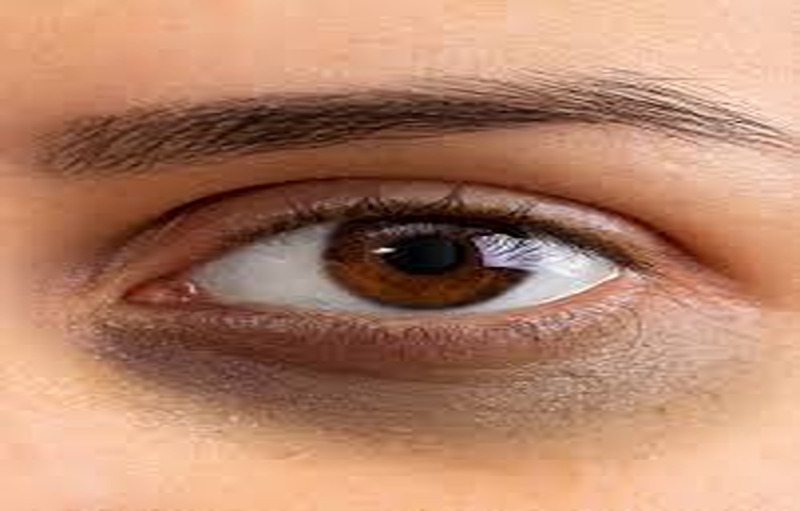Foods To Eat To Get Rid Of Dark Circles