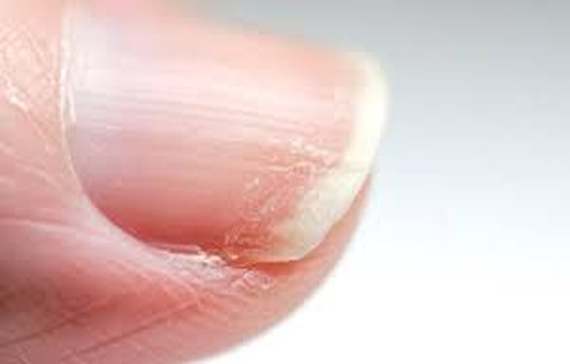 Zinc Deficiency May be Related to Testosterone Production