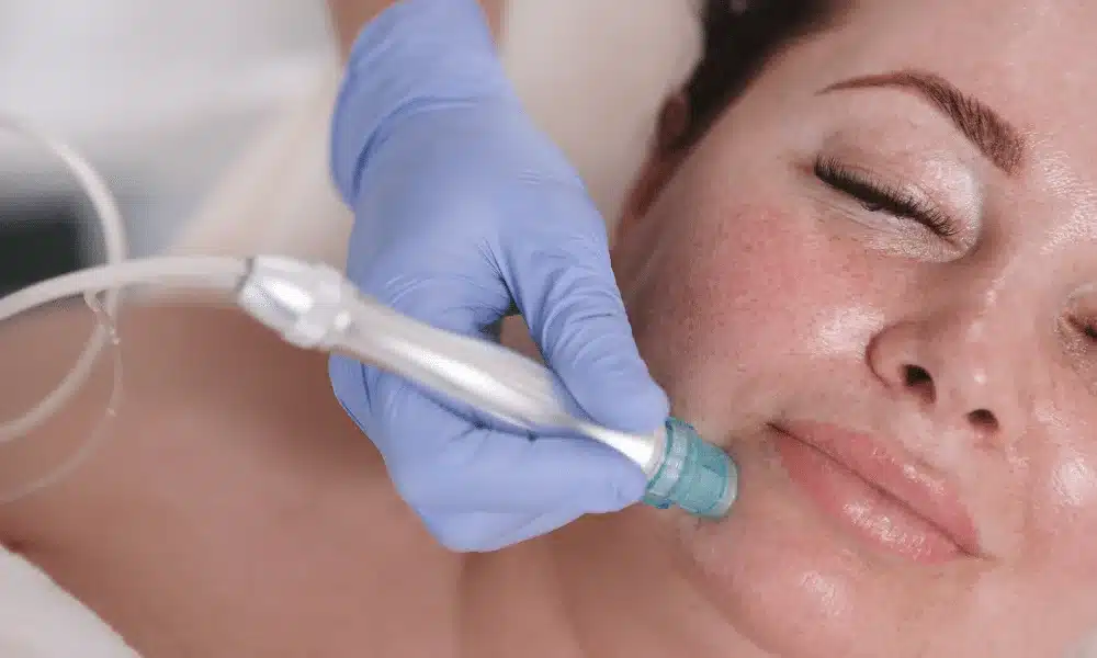 Common Non-Surgical Procedures for Facial Rejuvenation